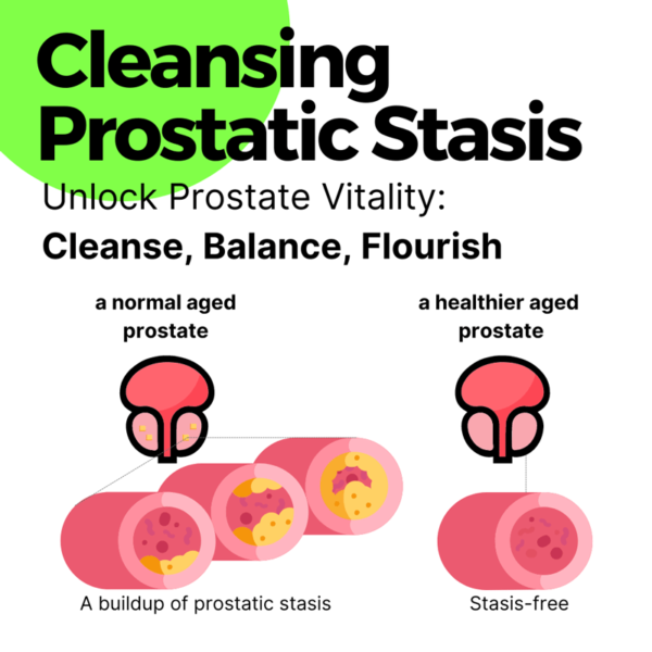 Cleansing Prostate stasis is essential to prostate health